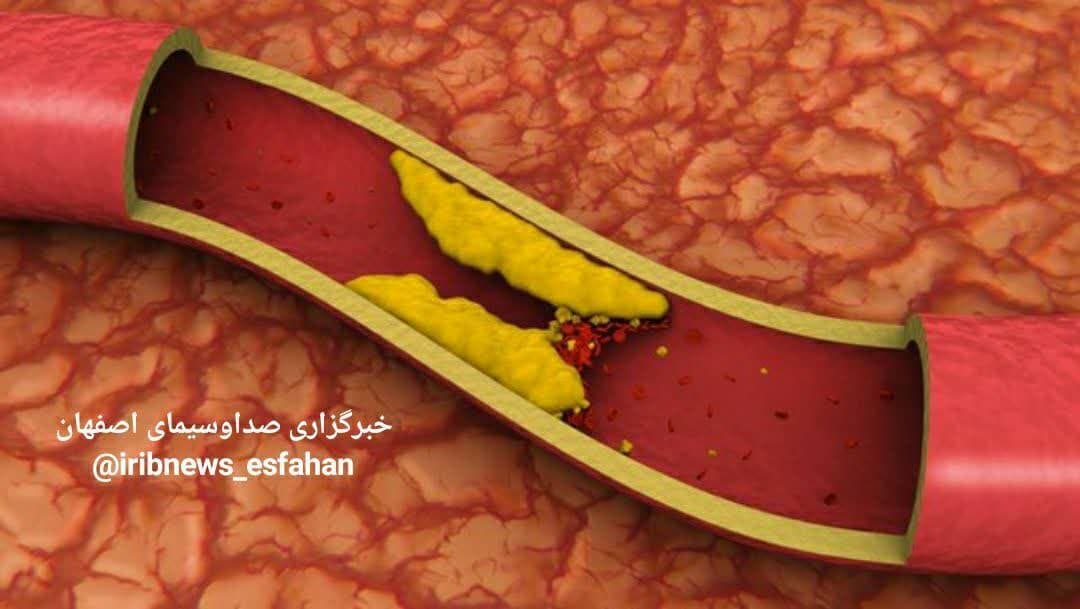 https://s2.uupload.ir/files/%D8%A8%D8%B1%D8%AE%DB%8C_%D8%A7%D8%B2_%D8%B9%D9%84%D9%84_vjt.jpg