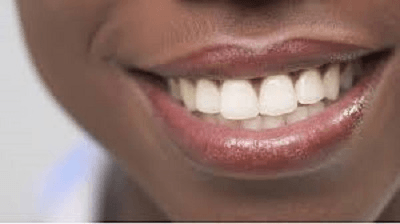 toothy-smile