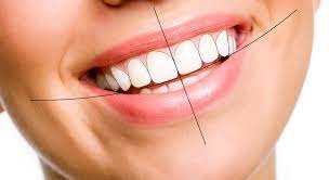 زیبایی-در-دندانپزشکی