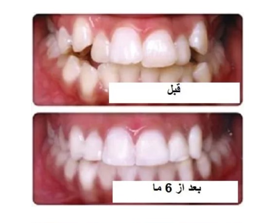 ارتودنسی