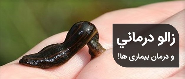 درمان بیماری با زالو در بهشهر